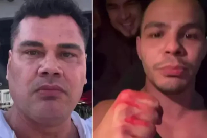 Sosyal Medya Fenomeni ve MMA Dövüşçüsü Kanlı Kavgada Karşı Karşıya