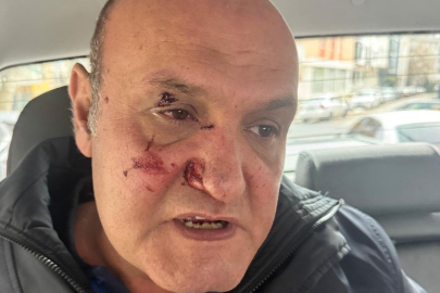 Kaldırıma park edilen aracın fotoğrafını çeken zabıtaya yumruklu saldırı