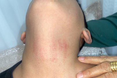 Kadın memurun 10 yaşındaki öğrenciyi okulda darbettiği iddiası