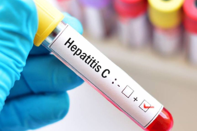 Uzmanlardan Hepatit C uyarısı: Yıllarca sessiz, sonu kanser olabiliyor